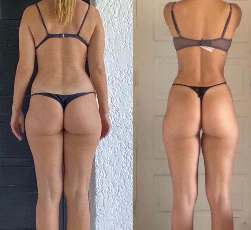Antes y después de Natalia, 6 meses con TAMFIT