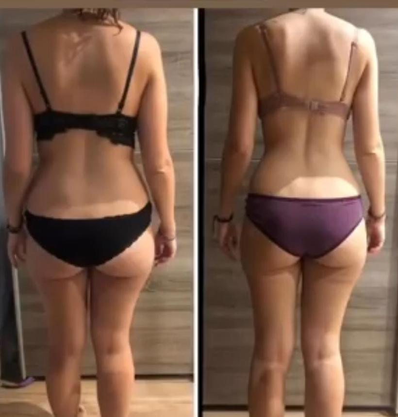 Antes y después de Lidia, 3 meses con TAMFIT